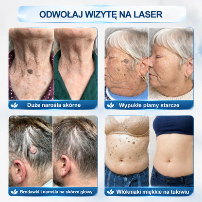 Oficjalny Sklep Markowy | ✅👩‍⚕️ 𝐏i𝐜𝐝o® 7-Dniowy 𝗧𝗮𝗴 & 𝗦𝗽𝗼𝐭 𝐄𝐫𝐚𝐬𝐞𝐫 (Bez bólu, Bez blizn – aplikator z kulką)💘