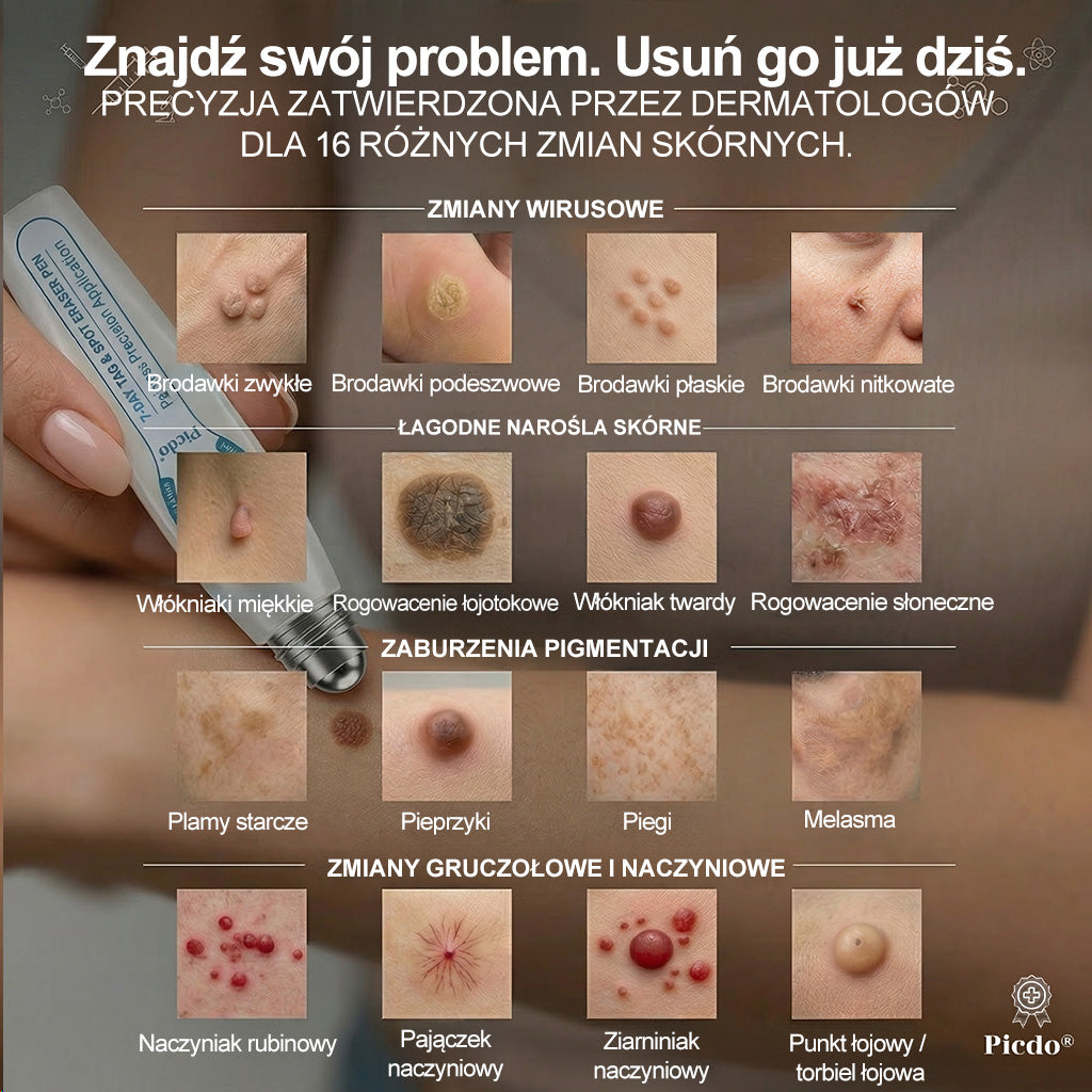 Oficjalny Sklep Markowy | ✅👩‍⚕️ 𝐏i𝐜𝐝o® 7-Dniowy 𝗧𝗮𝗴 & 𝗦𝗽𝗼𝐭 𝐄𝐫𝐚𝐬𝐞𝐫 (Bez bólu, Bez blizn – aplikator z kulką)💘